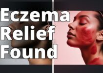 Cannabidiol For Eczema: The Ultimate Guide To Benefits, Dosage, And Safety