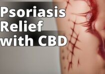 The Ultimate Guide To Using Cannabidiol For Psoriasis Management